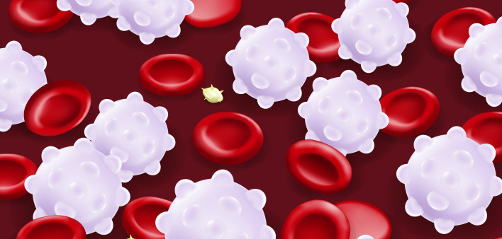 Leukemia. Red blood cells, White blood cells and platelets.