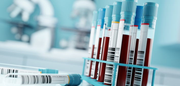 Blood Test Results In A Medical Lab stock photo Blood Test, Blood, Laboratory, Medical Test, Medical Exam