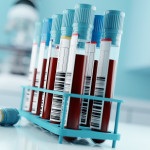 Blood Test Results In A Medical Lab stock photo Blood Test, Blood, Laboratory, Medical Test, Medical Exam