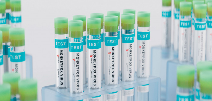 Monkeypoz vials test