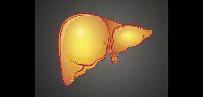 fatty liver