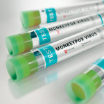 tubes monkeypox virus