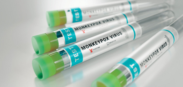 tubes monkeypox virus