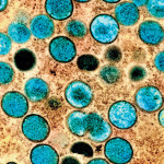 Monkeypox virus