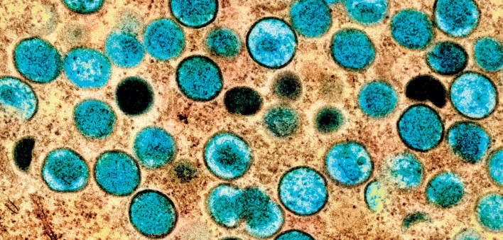 Monkeypox virus