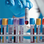 Hand drawing a blood sample tube