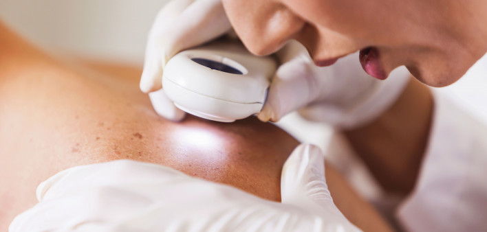 Dermatologist looking at skin with a magnifier skin cancer check