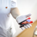 female medical worker holding blood vials after a blood donation