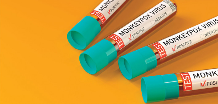 Vials with blood marked Monekypox