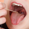 Oral exam