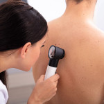 doctor looking for skin cancer melanoma