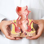 doctor holding model of colon and rectum