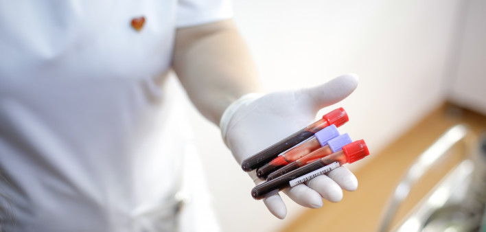 female medical worker holding blood vials after a blood donation