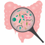 Bacterial overgrowth in small intestine.
