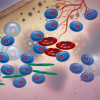 Multiple myeloma cells