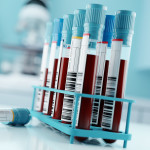 Blood Test Results In A Medical Lab stock photo Blood Test, Blood, Laboratory, Medical Test, Medical Exam