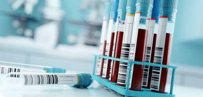 Blood Test Results In A Medical Lab stock photo Blood Test, Blood, Laboratory, Medical Test, Medical Exam