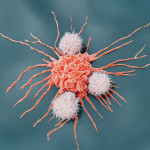 Natural killer cells are lymphocytes that target virus infected cells and tumor cells