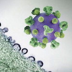 HIV virus particles (purple) budding and replicating from an H9 T cell (green)