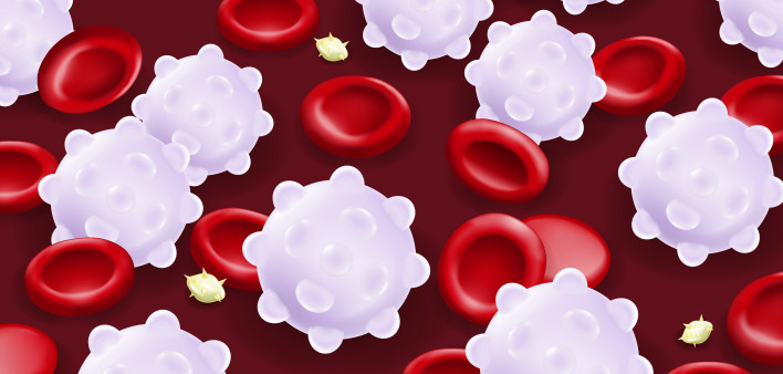 Leukemia. Red blood cells, White blood cells and platelets.