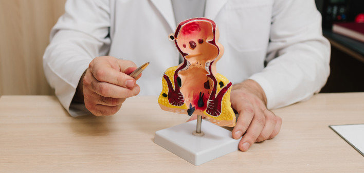 Rectum pathology model for educational demonstration in medical training