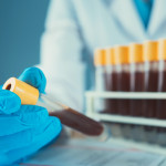 Blood vials in laboratory scientist