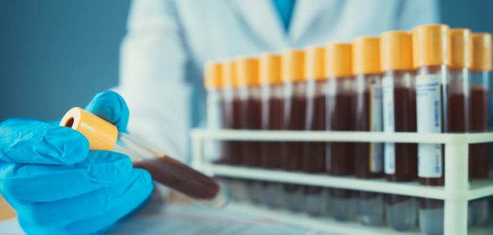Blood vials in laboratory scientist