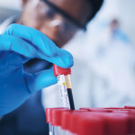 technition holding vial of blood