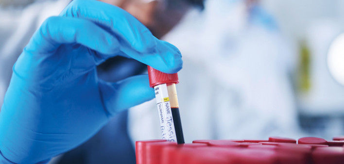 technition holding vial of blood