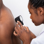 skin cancer screening black man
