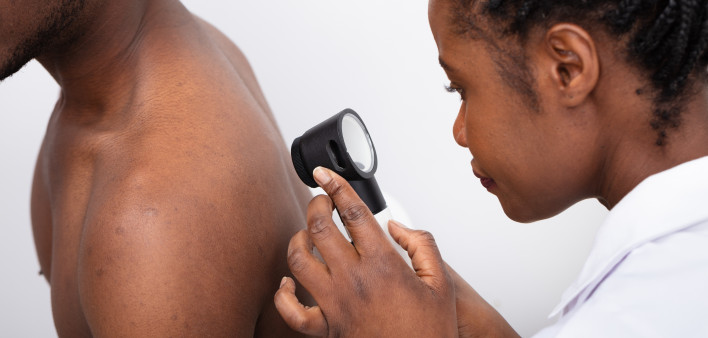 skin cancer screening black man