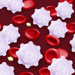 Leukemia. Red blood cells, White blood cells and platelets.