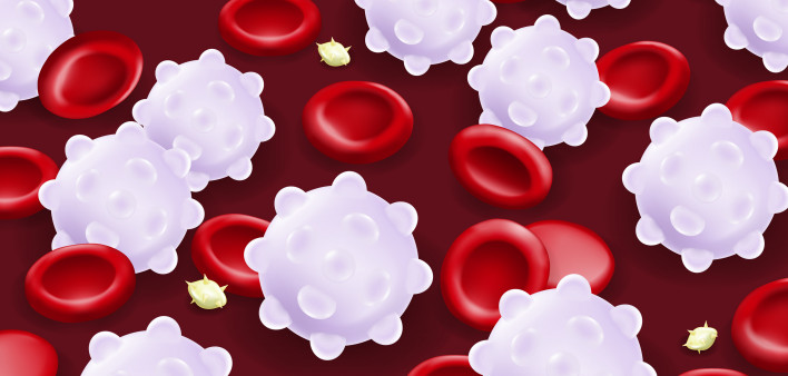 Leukemia. Red blood cells, White blood cells and platelets.