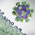 HIV virus particles (purple) budding and replicating from an H9 T cell (green)