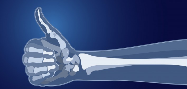  bones skeleton x-ray