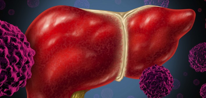 An illustration of a liver and virus particles