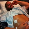 Devon Nicholson after undergoing a liver biopsy