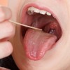 Oral exam