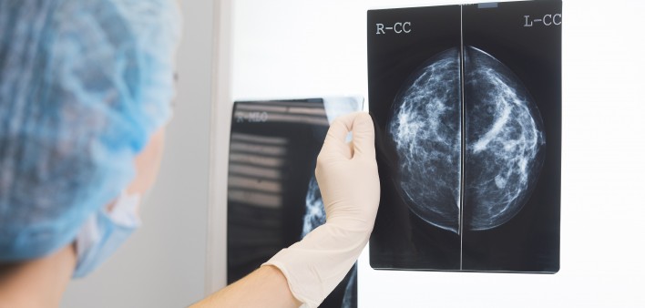 Mammogram image