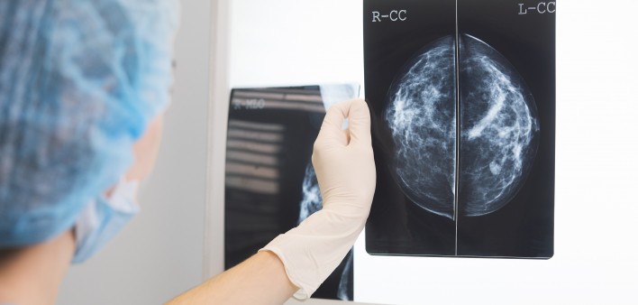 Mammogram image