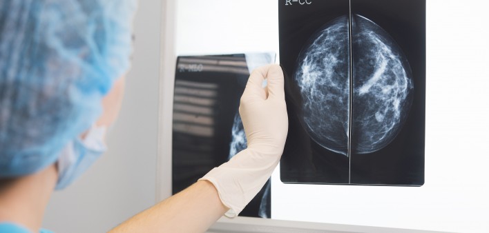 Mammogram image