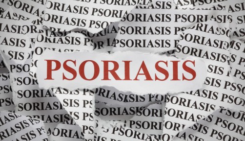 psoriasis word