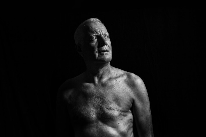 Jose Ferreira, male breast cancer
