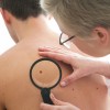 Skin cancer examination