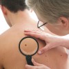Skin cancer examination