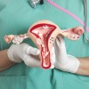 Female reproductive system