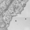 A nanoparticle arrives to brain glioma tissue (arrow). Carefully designed nanoparticles, embellished with a variety of molecules to target a specific organ of interest, can be used to transport hydrophobic drugs to a particular site in the body.