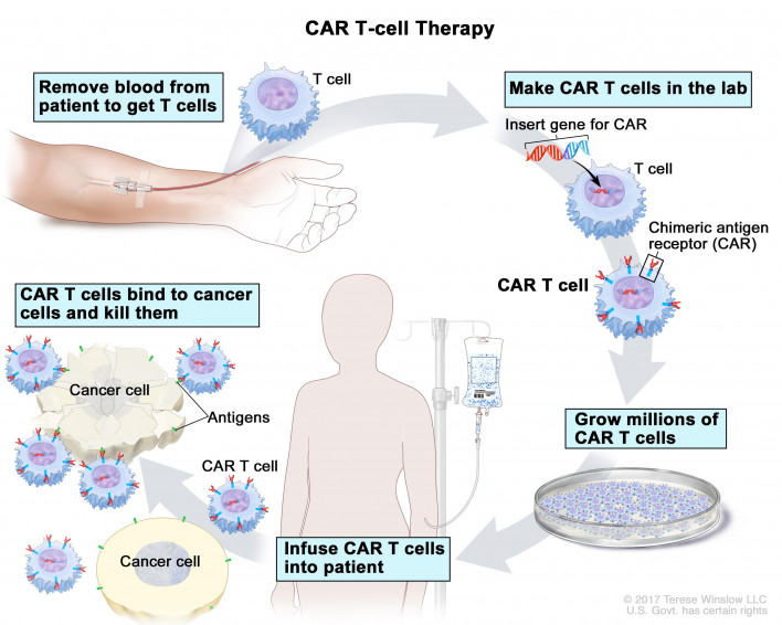 NCI CAR-T
