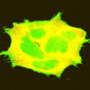 When cells express more EndoA3, they make more of the finger- and arm-like projections they use to move (seen in green).