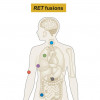 Cancers with RET fusions (Drilon et al, ASCO 2018, abstract 102)
